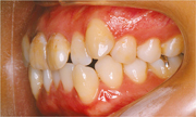 術前